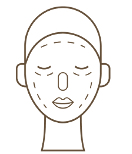 Peeling-Quimico-Clinic-Mallorca-MED